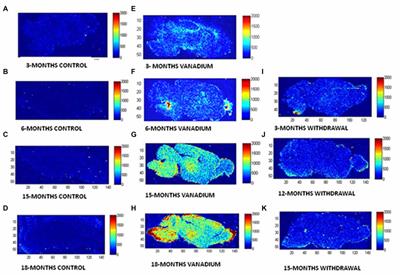 Brain Metal Distribution and Neuro-Inflammatory Profiles after Chronic Vanadium Administration and Withdrawal in Mice